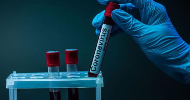На Херсонщині зафіксували 108 нових лабораторно підтверджених випадків захворювання на COVID-19