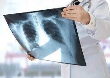 Кропивницький: КП «Електротранс» повідомляє про знайдений рентген-знімок