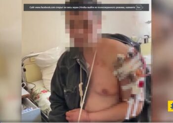 Мешканець Київщини розповідає про тортури, які пережив під час окупації (ВІДЕО)