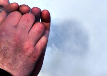 Як запобігти обмороженню: поради Міністерства охорони здоров`я