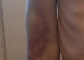 На Дніпропетровщині затримали катівника, що тримав на ланцюгу п’ятирічного пасинка – Новини Кам’янське